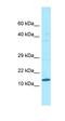 Variable Charge Y-Linked 1B antibody, orb326562, Biorbyt, Western Blot image 