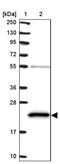 ATP Synthase Peripheral Stalk Subunit D antibody, PA5-61742, Invitrogen Antibodies, Western Blot image 