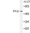 Estrogen Receptor 2 antibody, LS-C176986, Lifespan Biosciences, Western Blot image 