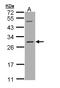 RAS Like Proto-Oncogene B antibody, LS-C186044, Lifespan Biosciences, Western Blot image 