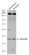 Ephrin B2 antibody, GTX105582, GeneTex, Western Blot image 