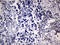 FOXP3 antibody, LS-C799070, Lifespan Biosciences, Immunohistochemistry paraffin image 