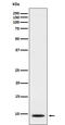 C-X-C Motif Chemokine Ligand 5 antibody, M00946, Boster Biological Technology, Western Blot image 