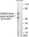 Calcium/Calmodulin Dependent Protein Kinase II Beta antibody, PA5-39731, Invitrogen Antibodies, Western Blot image 