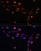 Protein Kinase C Beta antibody, 15-109, ProSci, Immunofluorescence image 