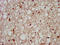 Melanocortin 3 Receptor antibody, LS-C670641, Lifespan Biosciences, Immunohistochemistry paraffin image 