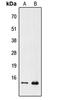 Prefoldin Subunit 1 antibody, abx121549, Abbexa, Western Blot image 