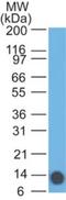 Epidermal Growth Factor Receptor Pathway Substrate 8 antibody, NBP2-27300, Novus Biologicals, Western Blot image 