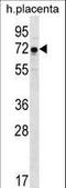 Glucosamine (UDP-N-Acetyl)-2-Epimerase/N-Acetylmannosamine Kinase antibody, LS-C166561, Lifespan Biosciences, Western Blot image 