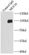 Mucin 16, Cell Surface Associated antibody, FNab05429, FineTest, Immunoprecipitation image 