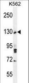 Tau Tubulin Kinase 2 antibody, LS-C160285, Lifespan Biosciences, Western Blot image 