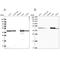 GTP-specific succinyl-CoA synthetase subunit beta antibody, NBP2-47610, Novus Biologicals, Western Blot image 