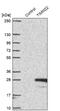 Translocase Of Inner Mitochondrial Membrane 22 antibody, NBP1-92509, Novus Biologicals, Western Blot image 