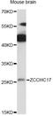 Zinc Finger CCHC-Type Containing 17 antibody, LS-C749872, Lifespan Biosciences, Western Blot image 