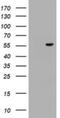 Oxysterol Binding Protein Like 2 antibody, NBP2-45878, Novus Biologicals, Western Blot image 