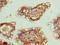Zinc Finger Protein 281 antibody, orb26478, Biorbyt, Immunohistochemistry paraffin image 