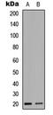 Nescient helix loop helix 1 antibody, abx121411, Abbexa, Western Blot image 