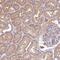 TRNA Splicing Endonuclease Subunit 54 antibody, PA5-62729, Invitrogen Antibodies, Immunohistochemistry paraffin image 