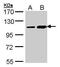 Trafficking Kinesin Protein 2 antibody, PA5-21858, Invitrogen Antibodies, Western Blot image 