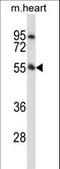 Serine/threonine-protein kinase PINK1, mitochondrial antibody, LS-C164534, Lifespan Biosciences, Western Blot image 