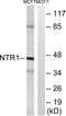 Neurotensin Receptor 1 antibody, LS-B5255, Lifespan Biosciences, Western Blot image 