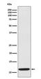 C-C Motif Chemokine Ligand 19 antibody, M01605, Boster Biological Technology, Western Blot image 