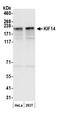 Kinesin Family Member 14 antibody, A300-233A, Bethyl Labs, Western Blot image 