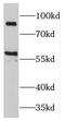 Mitogen-Activated Protein Kinase Kinase Kinase Kinase 2 antibody, FNab04981, FineTest, Western Blot image 