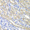 SURF1 Cytochrome C Oxidase Assembly Factor antibody, STJ114395, St John
