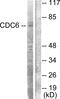 Cell Division Cycle 6 antibody, LS-C117595, Lifespan Biosciences, Western Blot image 