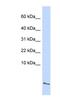 Serum Amyloid A4, Constitutive antibody, NBP1-58991, Novus Biologicals, Western Blot image 