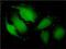 Thioredoxin Domain Containing 9 antibody, H00010190-M02, Novus Biologicals, Immunocytochemistry image 