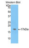 Alpha-2-macroglobulin antibody, LS-C304744, Lifespan Biosciences, Western Blot image 