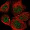 Calcium Voltage-Gated Channel Auxiliary Subunit Beta 2 antibody, NBP1-86680, Novus Biologicals, Immunocytochemistry image 