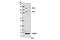 Progesterone Receptor antibody, 8757P, Cell Signaling Technology, Western Blot image 