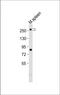 Mediator Complex Subunit 12 antibody, M00828, Boster Biological Technology, Western Blot image 