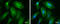 Myosin Heavy Chain 10 antibody, GTX634160, GeneTex, Immunocytochemistry image 