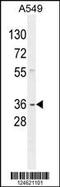 G Protein Subunit Alpha Transducin 3 antibody, 55-210, ProSci, Western Blot image 