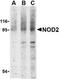 Nucleotide Binding Oligomerization Domain Containing 2 antibody, TA306091, Origene, Western Blot image 