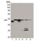 Serpin Family H Member 1 antibody, M03050, Boster Biological Technology, Western Blot image 