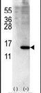 ISG15 Ubiquitin Like Modifier antibody, PA5-11270, Invitrogen Antibodies, Western Blot image 