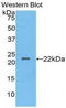 Interleukin 2 antibody, LS-C299445, Lifespan Biosciences, Western Blot image 
