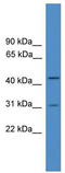 OTU Deubiquitinase 6A antibody, TA342556, Origene, Western Blot image 