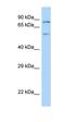 Protein Inhibitor Of Activated STAT 2 antibody, orb330731, Biorbyt, Western Blot image 