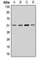 Retinoic Acid Receptor Alpha antibody, orb411607, Biorbyt, Western Blot image 