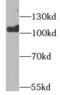 Enhancer Of Zeste 2 Polycomb Repressive Complex 2 Subunit antibody, FNab02918, FineTest, Western Blot image 