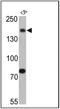 Synaptojanin 1 antibody, GTX15835, GeneTex, Western Blot image 