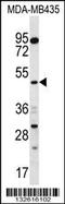 Sorting Nexin 4 antibody, 56-693, ProSci, Western Blot image 
