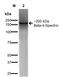 Spectrin Beta, Non-Erythrocytic 5 antibody, orb376693, Biorbyt, Western Blot image 