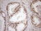 O-6-Methylguanine-DNA Methyltransferase antibody, LS-C800058, Lifespan Biosciences, Immunohistochemistry paraffin image 